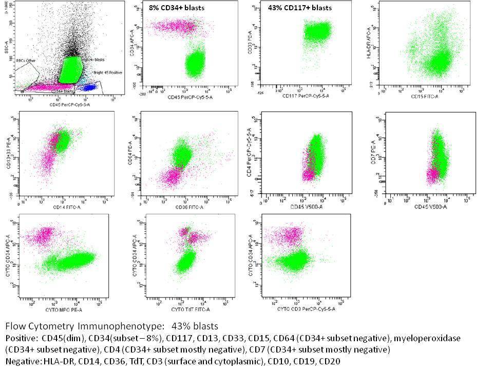 Bone marrow flow cytometry #2: There are approximately 43% blasts. Although a small subset (8% of total events) have an immunophenotype similar to the blasts seen in the first bone marrow, the majority of the blasts are now CD34-, CD117+, CD13/CD33+, HLA-DR-, CD15+, CD64+, myeloperoxidase+, CD4+, and CD7+.